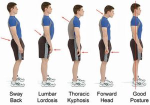 Bad Postures That Are Ruining Your Health & How to Correct Them