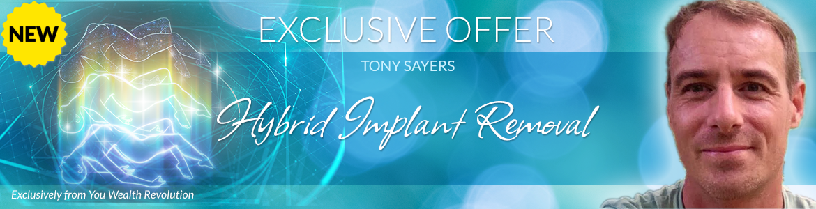 Welcome to Tony Sayers' Special Offer Page: Hybrid Implant Removal